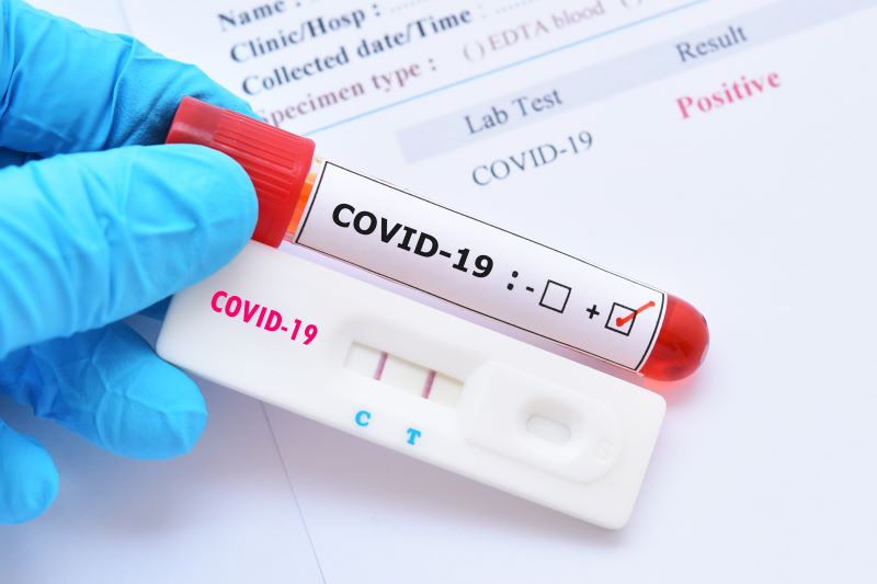 Teste de Covid-19 pode ser deduzido do imposto de renda?