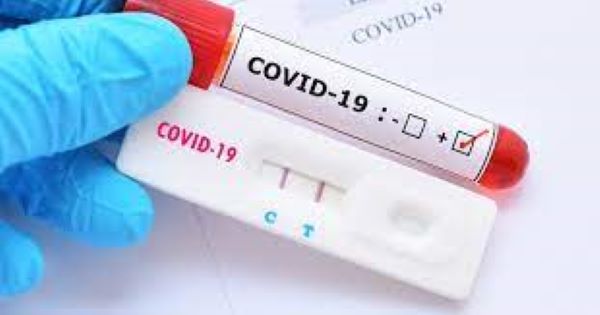 Testes de Covid podem ser deduzidos do Imposto de Renda
