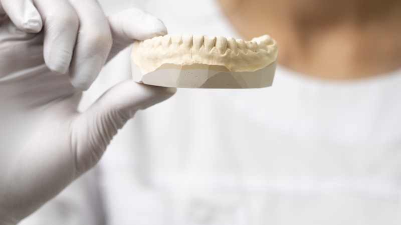 Mercado de próteses dentárias cresce com inovação